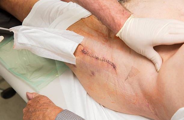 Цели и задачи реабилитации и абилитации | КГБУ "Ванинский комплексный центр социального обслуживания населения"